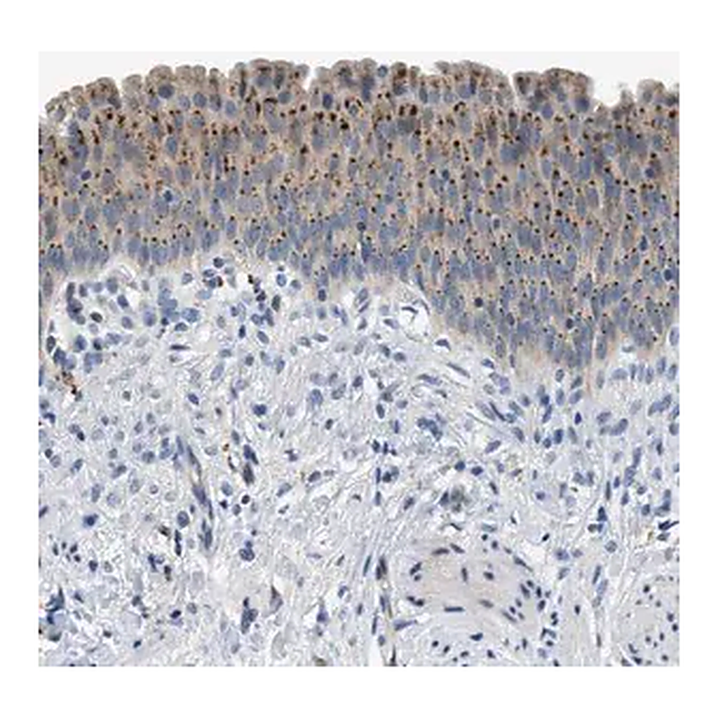 Merck Anti-ADGRE3 antibody produced in rabbit