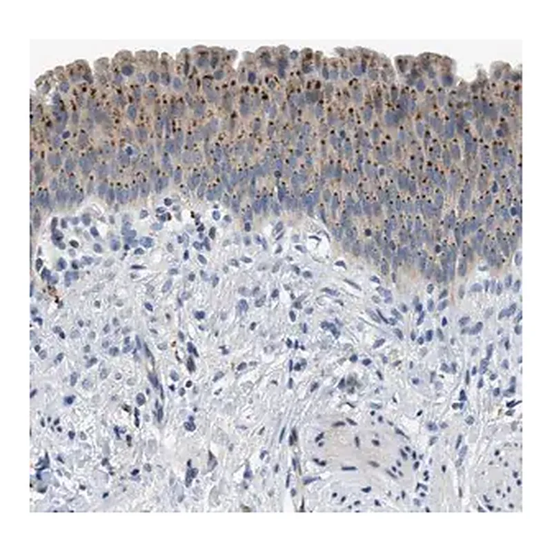Merck Anti-ADGRE3 antibody produced in rabbit
