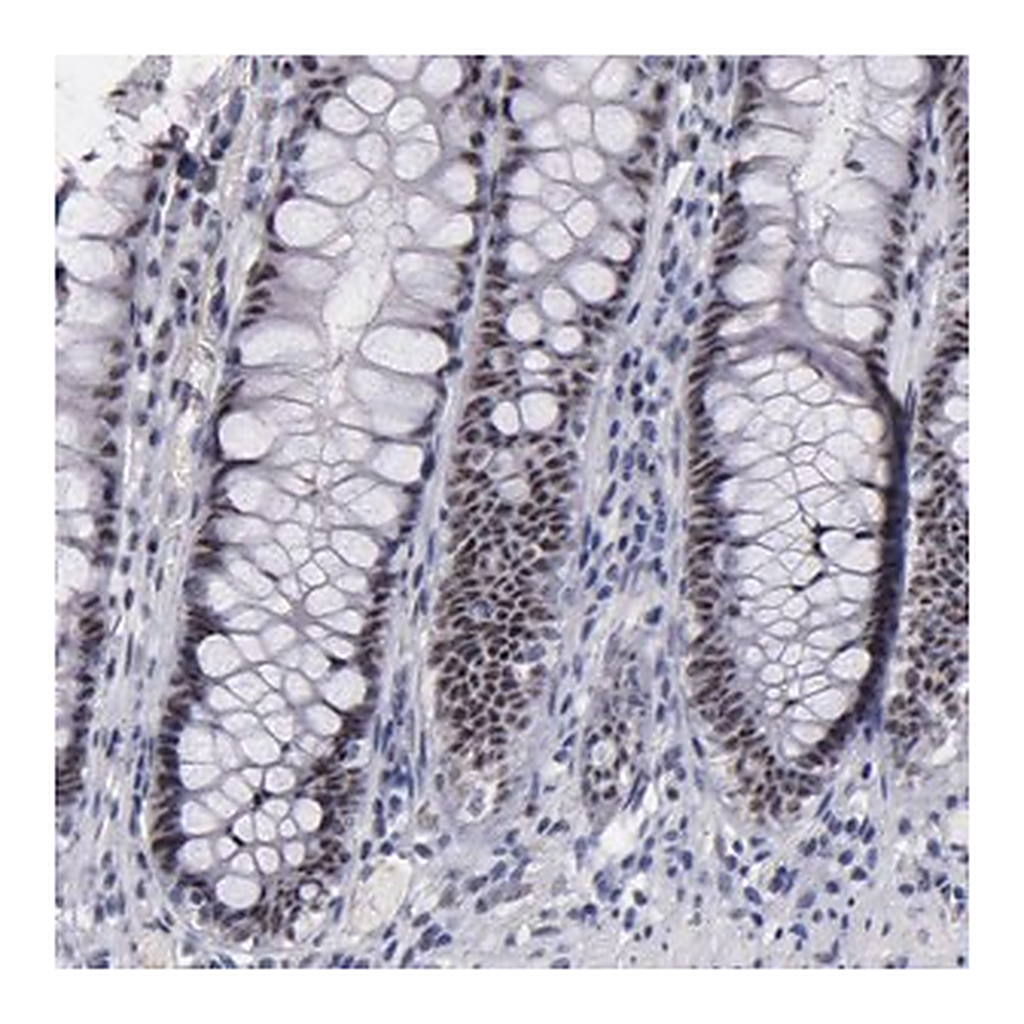 Merck Anti-RAF1 antibody produced in rabbit