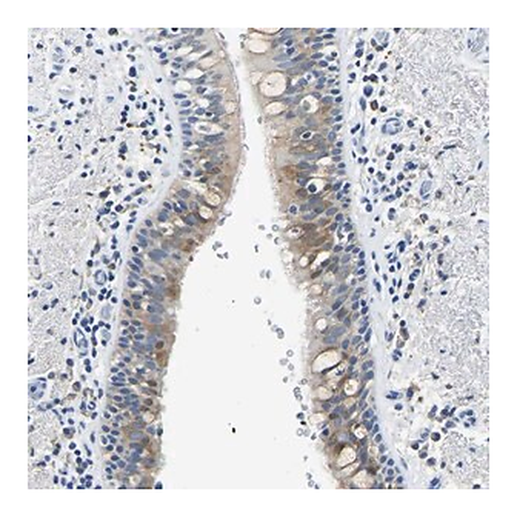 Merck Anti-ZDHHC13 antibody produced in rabbit