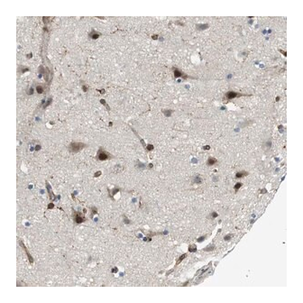 Merck Anti-PALD1 antibody produced in rabbit