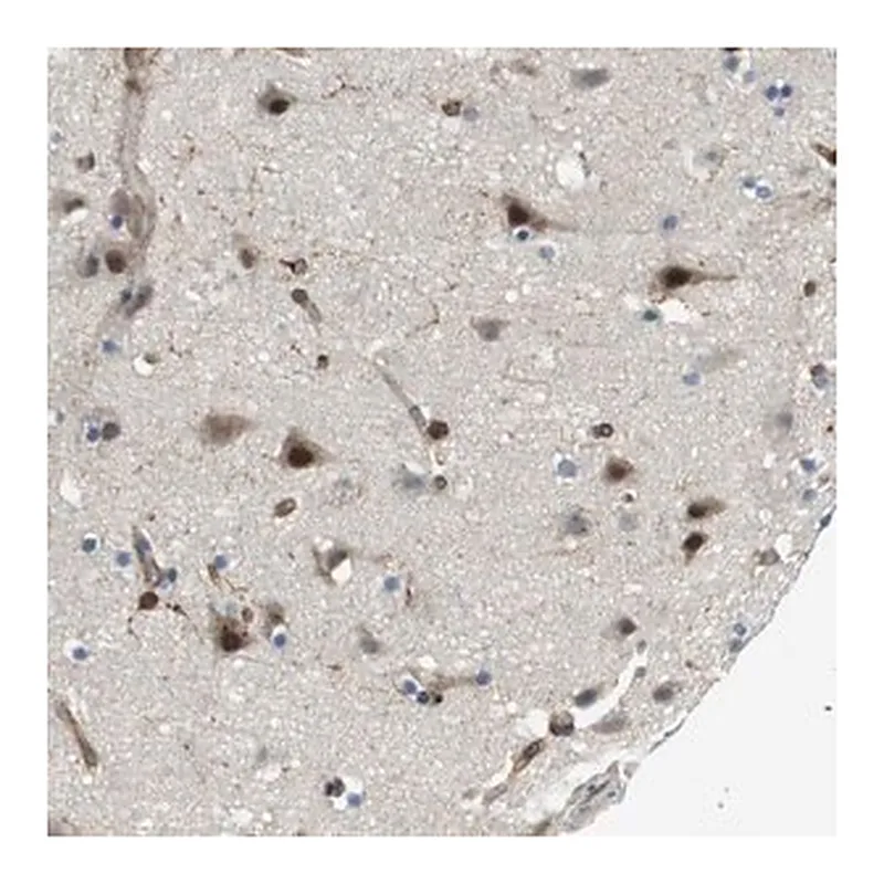 Merck Anti-PALD1 antibody produced in rabbit
