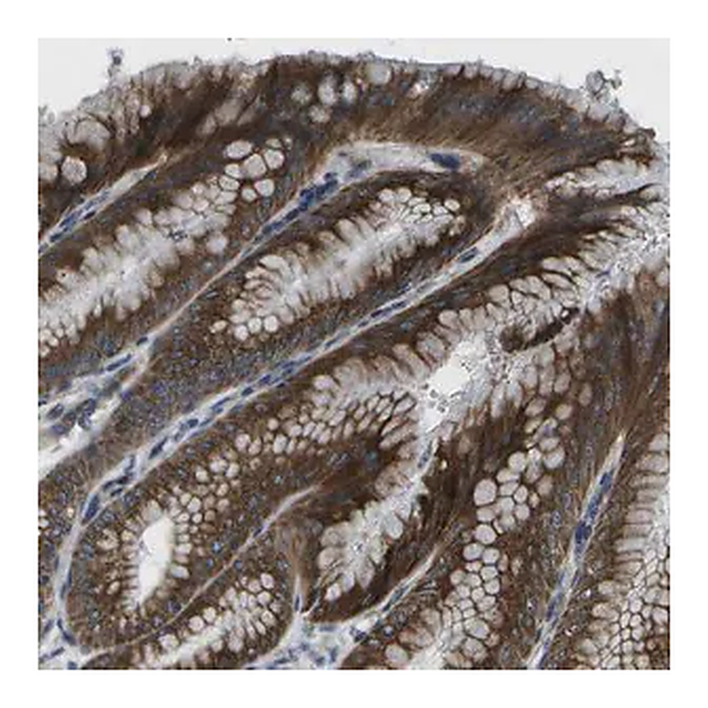 Merck Anti-GDF5 antibody produced in rabbit