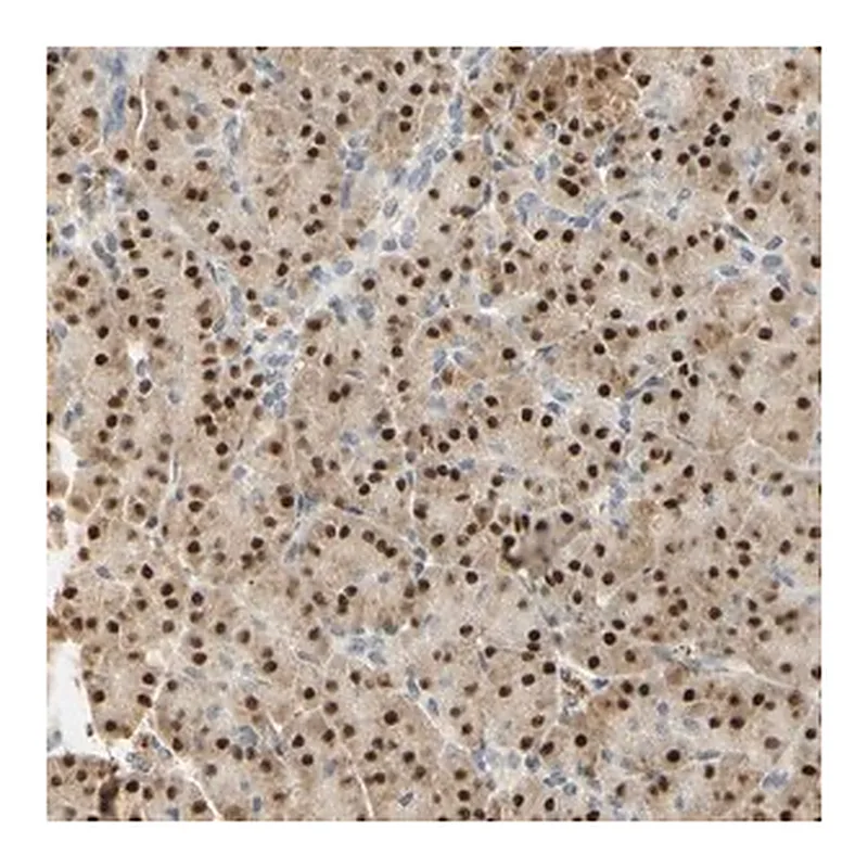 Merck Anti-MAP3K4 antibody produced in rabbit