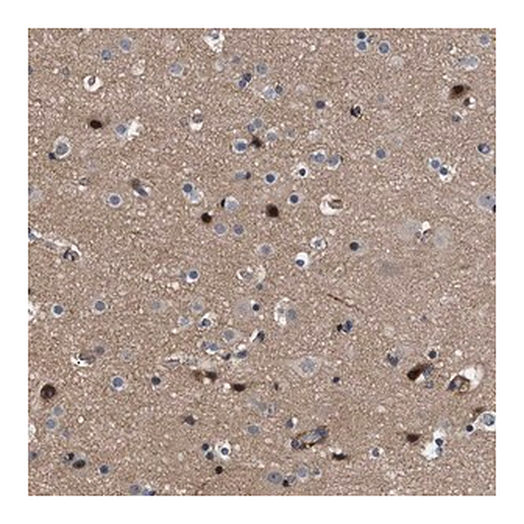 Merck Anti-SPAST antibody produced in rabbit