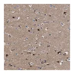 Merck Anti-SPAST antibody produced in rabbit
