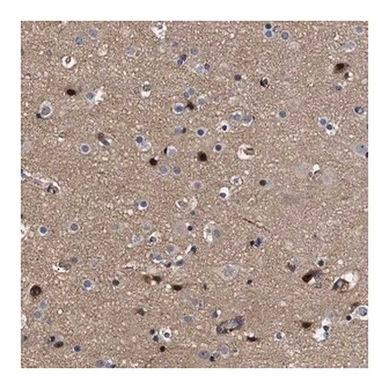 Merck Anti-SPAST antibody produced in rabbit
