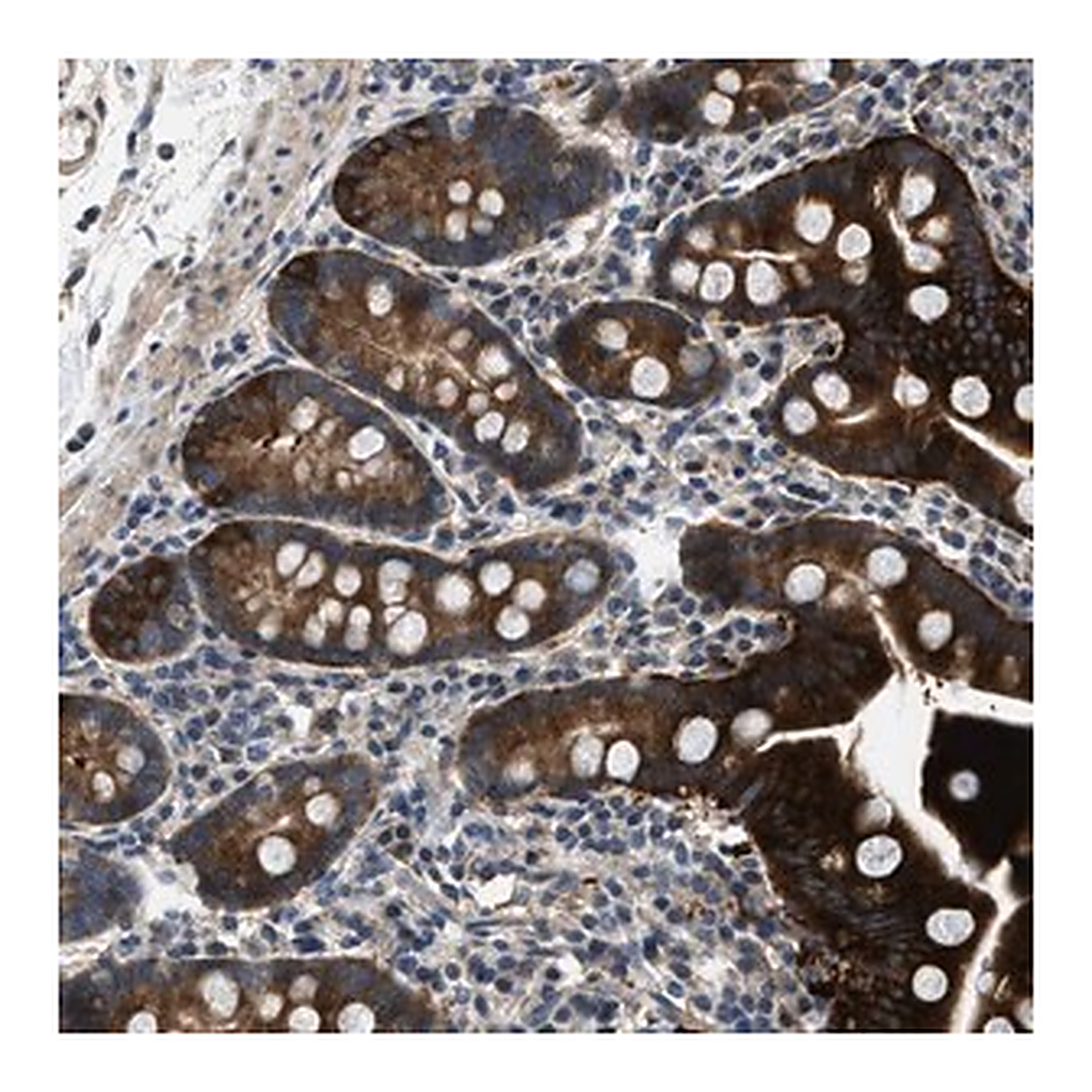 Merck Anti-LPIN2 antibody produced in rabbit