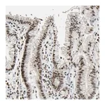 Merck Anti-C1orf174 antibody produced in rabbit
