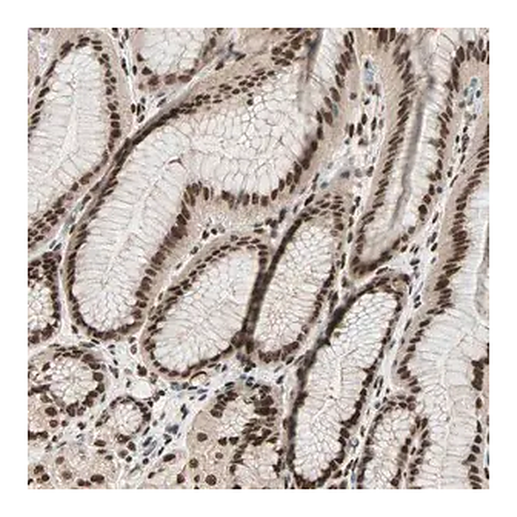 Merck Anti-BLM antibody produced in rabbit