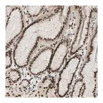 Merck Anti-BLM antibody produced in rabbit