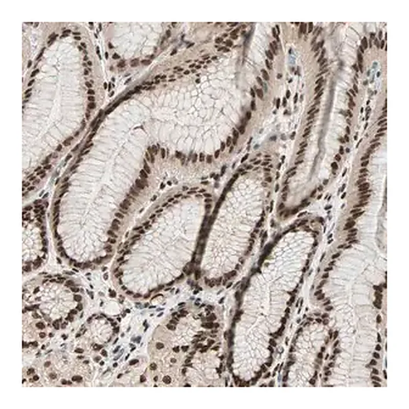 Merck Anti-BLM antibody produced in rabbit