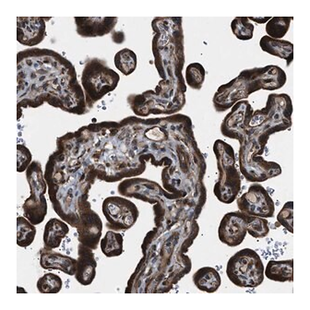 Merck Anti-LYSMD3 antibody produced in rabbit