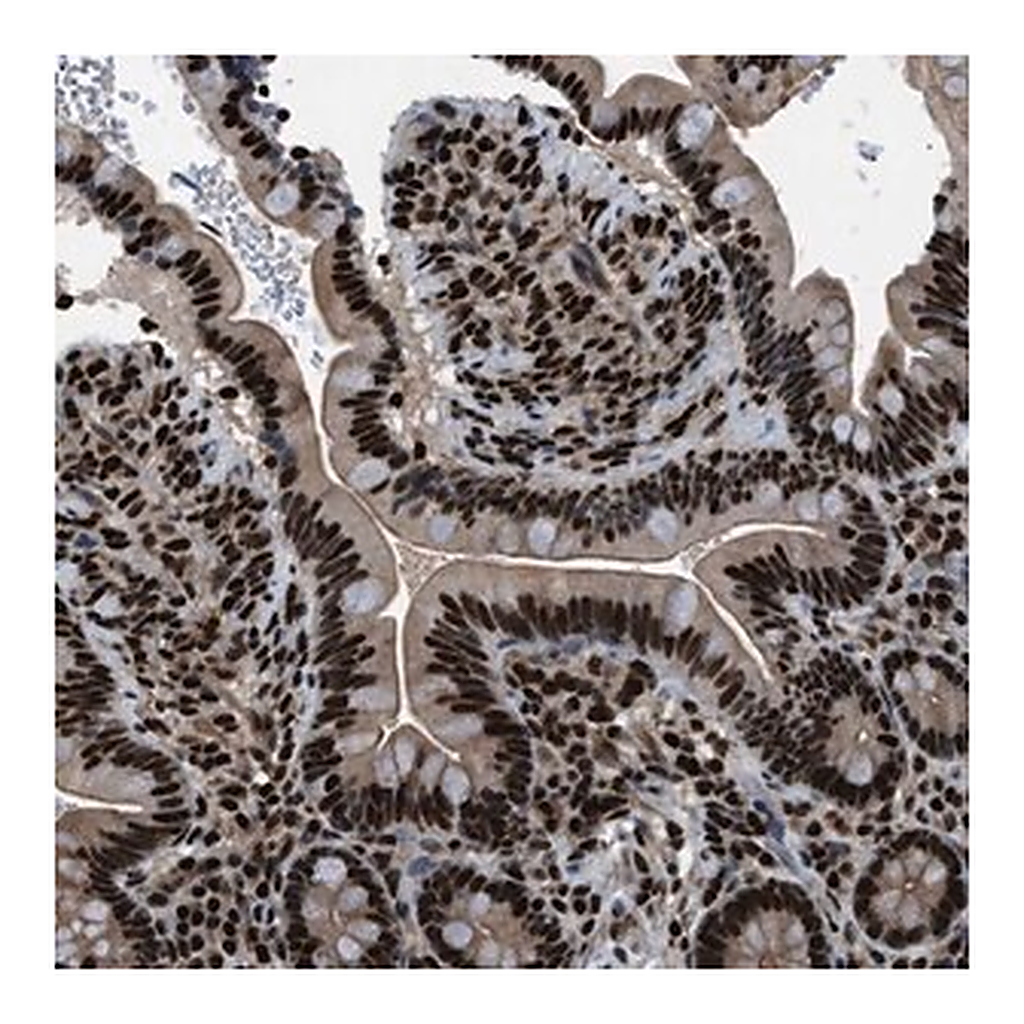 Merck Anti-PRKX antibody produced in rabbit