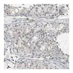 Merck Anti-PTGDS antibody produced in rabbit