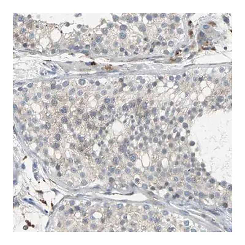 Merck Anti-PTGDS antibody produced in rabbit