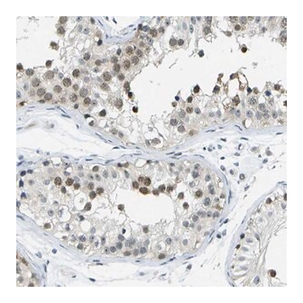 Merck Anti-PITHD1 antibody produced in rabbit