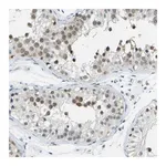 Merck Anti-PITHD1 antibody produced in rabbit
