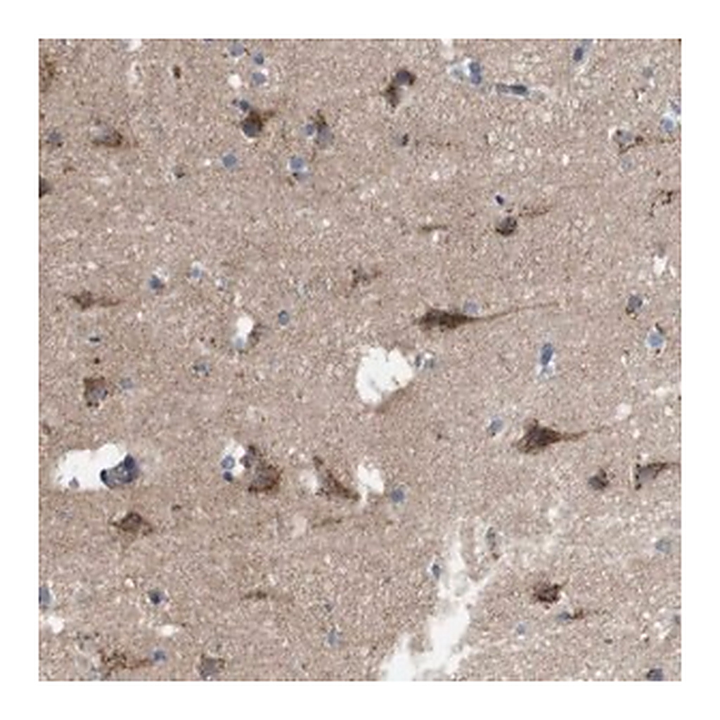 Merck Anti-EFCAB14 antibody produced in rabbit