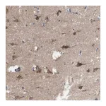 Merck Anti-EFCAB14 antibody produced in rabbit