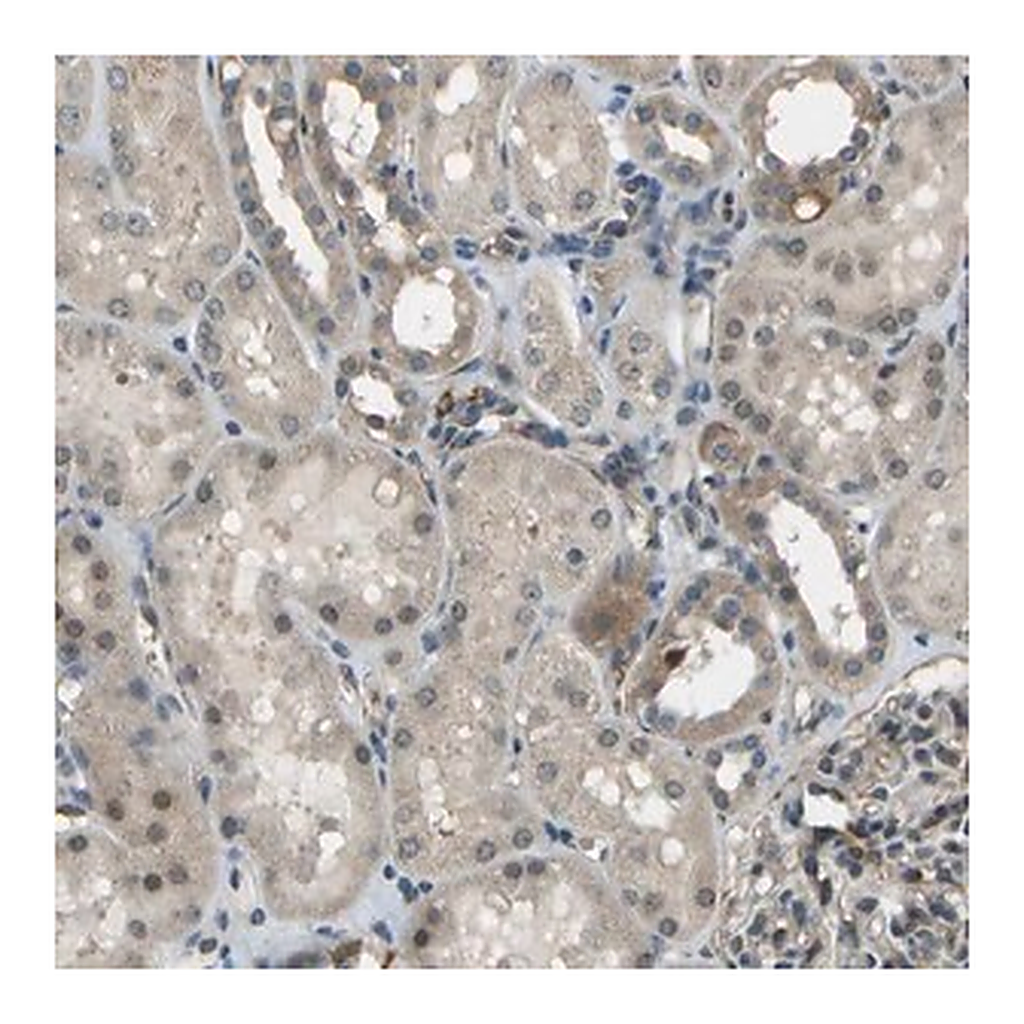 Merck Anti-CTIF antibody produced in rabbit