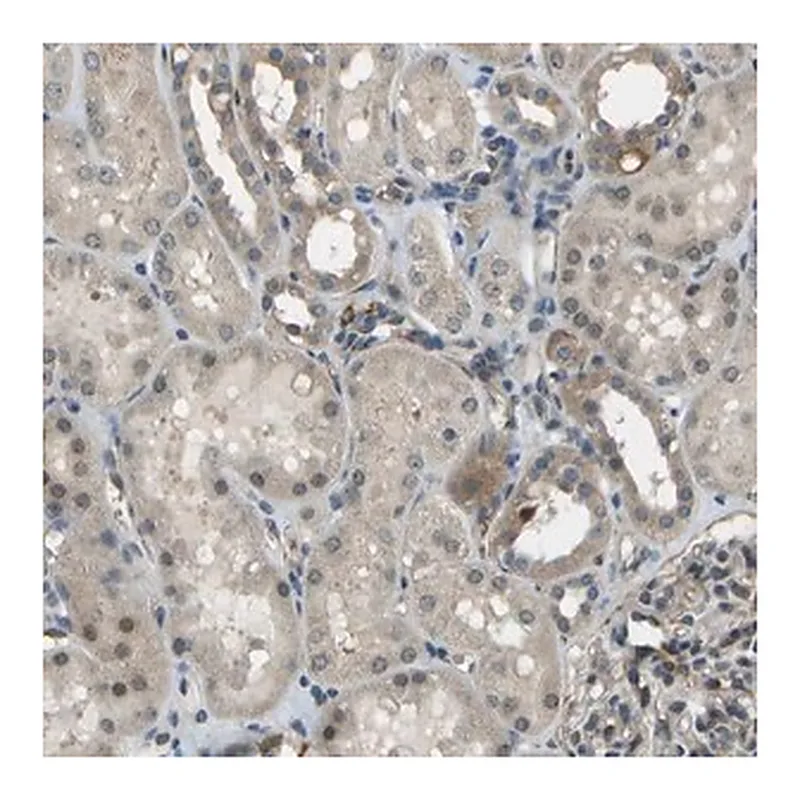 Merck Anti-CTIF antibody produced in rabbit