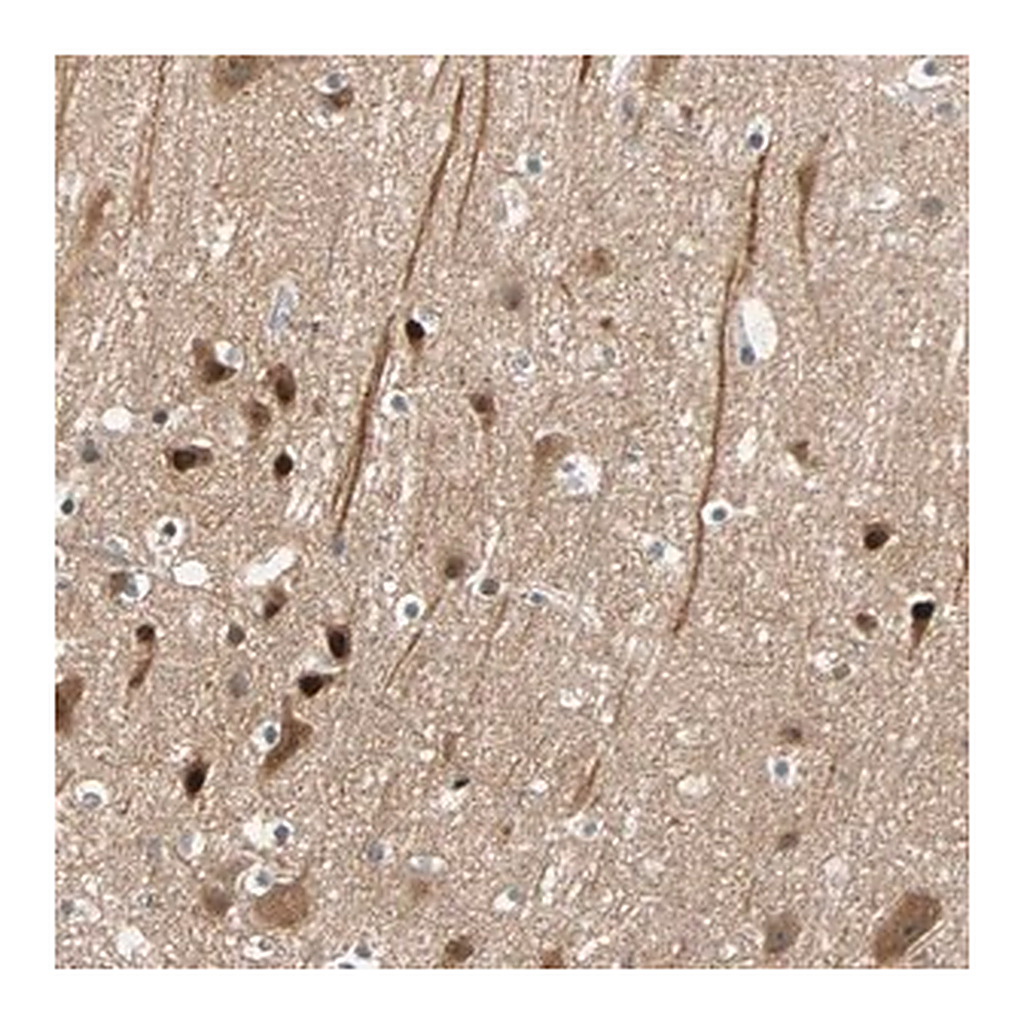 Merck Anti-HECW1 antibody produced in rabbit