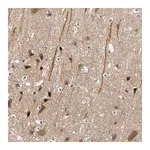 Merck Anti-HECW1 antibody produced in rabbit