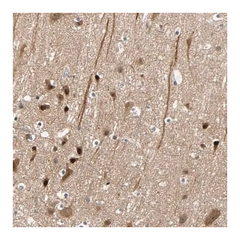 Merck Anti-HECW1 antibody produced in rabbit