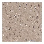 Merck Anti-HSPA13 antibody produced in rabbit