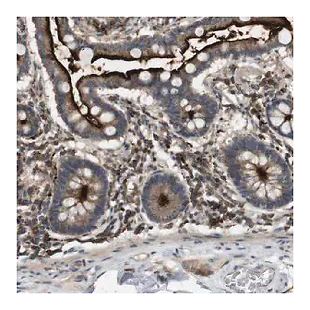 Merck Anti-KSR1 antibody produced in rabbit