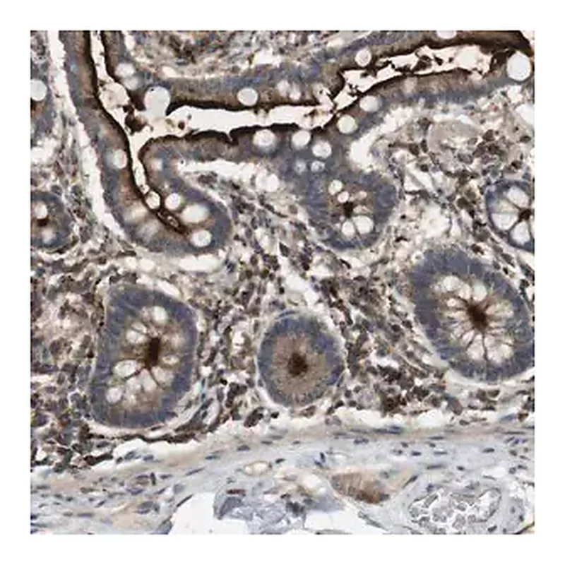 Merck Anti-KSR1 antibody produced in rabbit