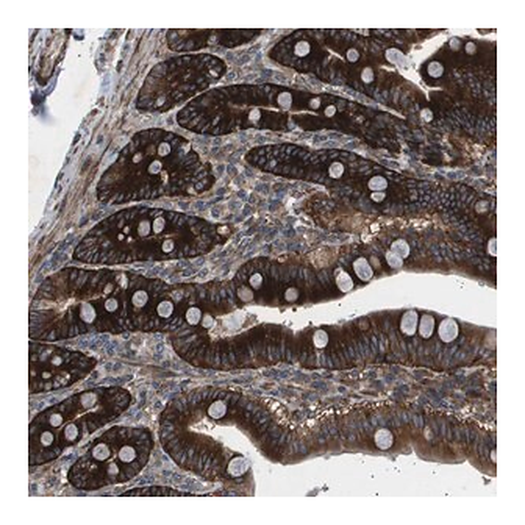 Merck Anti-OR51J1 antibody produced in rabbit