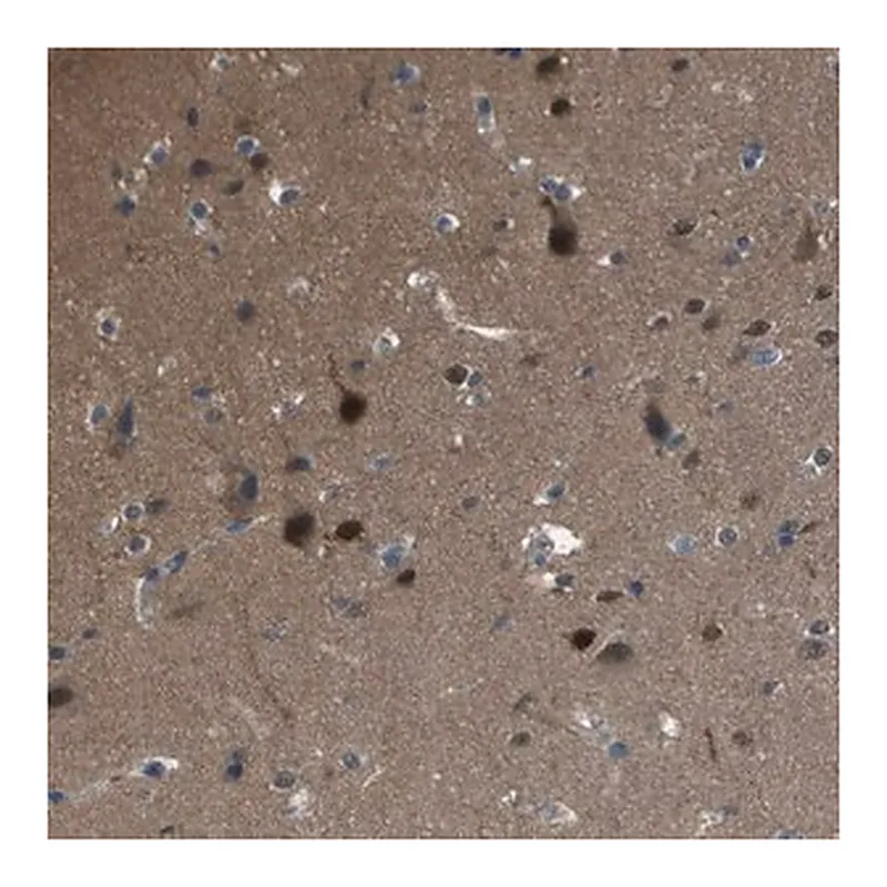 Merck Anti-CAMK4 antibody produced in rabbit