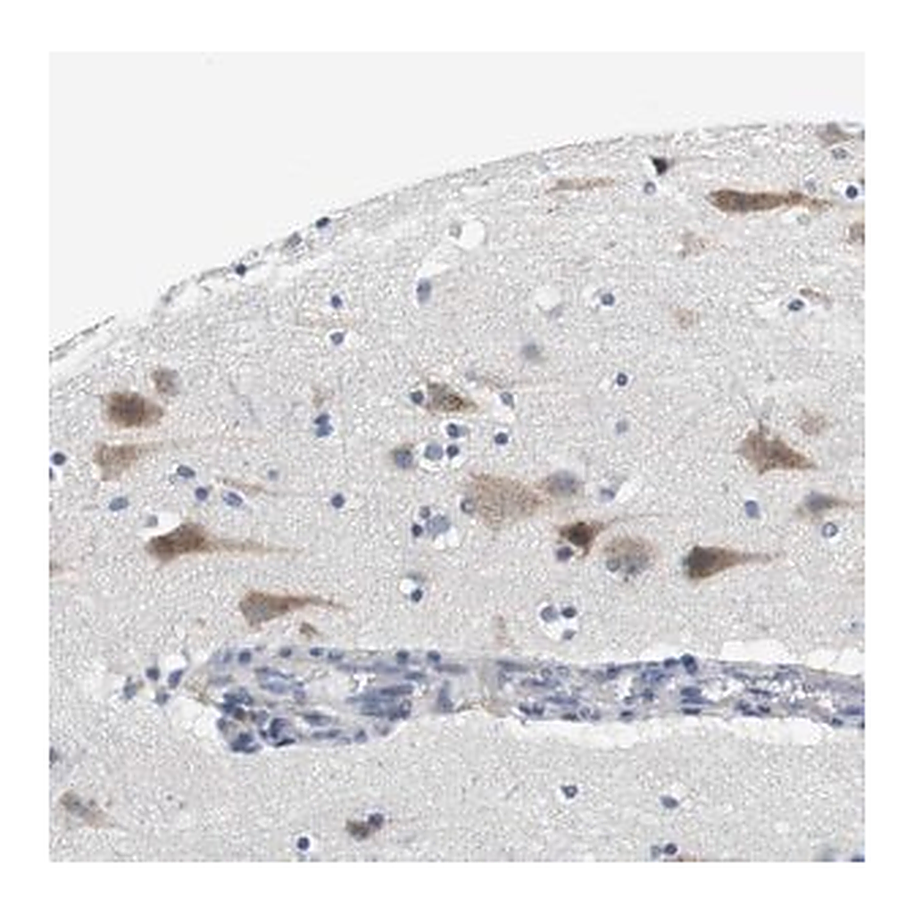 Merck Anti-CNGA2 antibody produced in rabbit