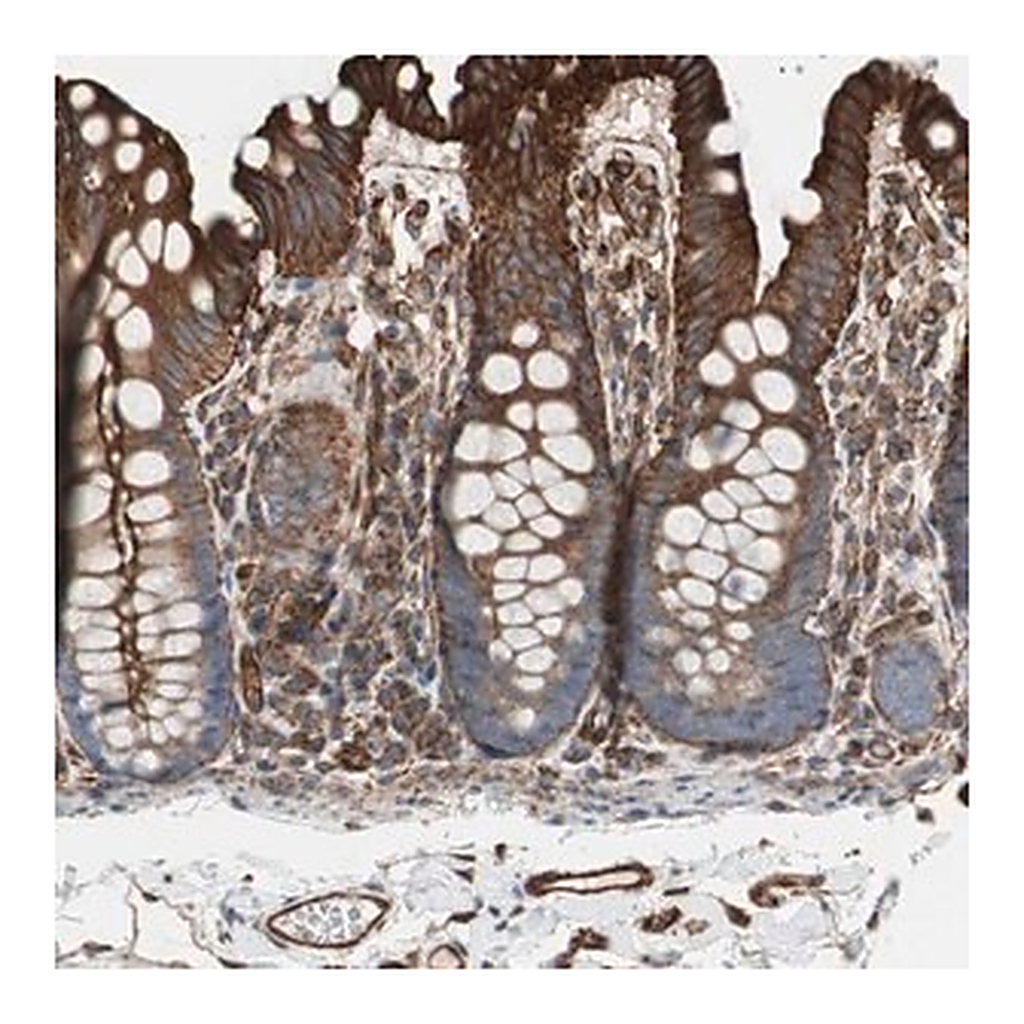 Merck Anti-TCTA antibody produced in rabbit