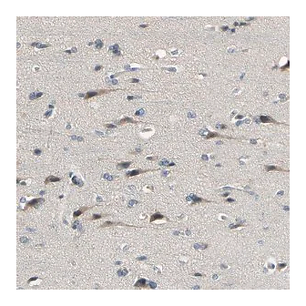 Merck Anti-PIP5K1B antibody produced in rabbit