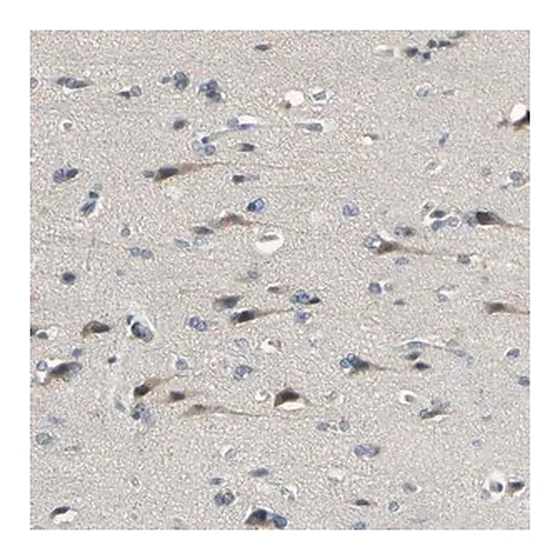 Merck Anti-PIP5K1B antibody produced in rabbit