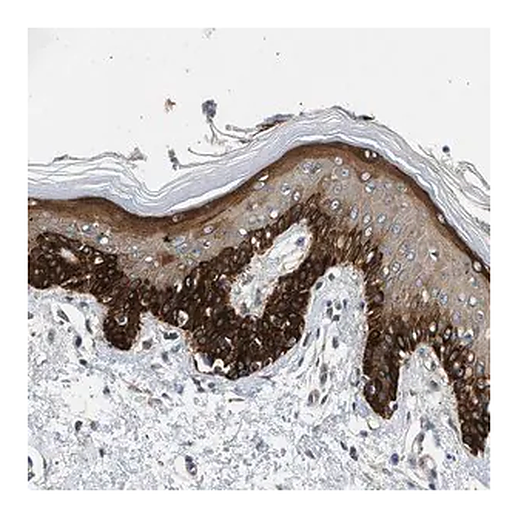 Merck Anti-RAPH1 antibody produced in rabbit