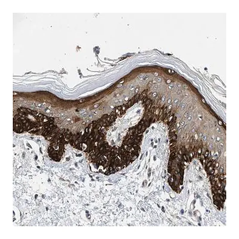 Merck Anti-RAPH1 antibody produced in rabbit