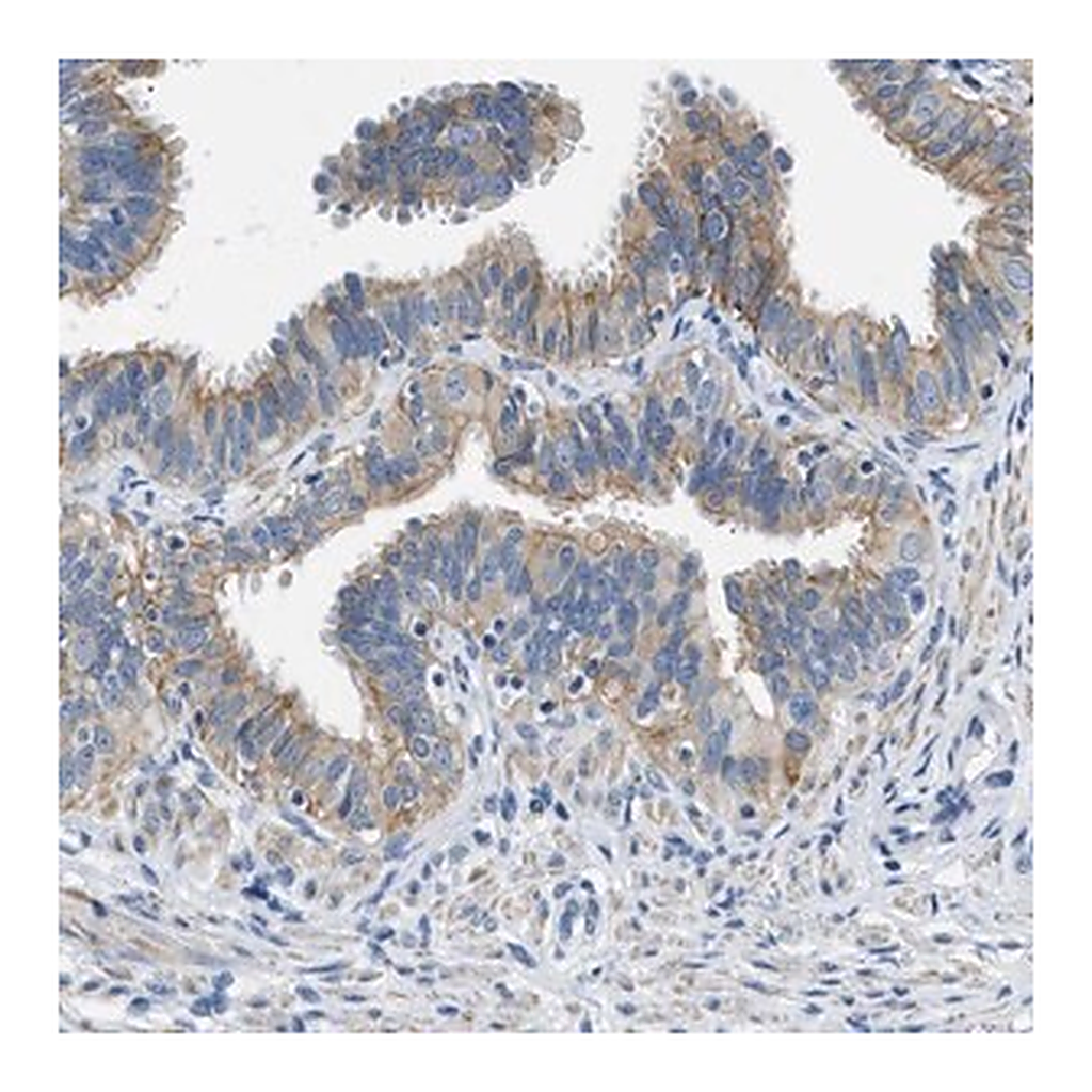 Merck Anti-CFAP20 antibody produced in rabbit