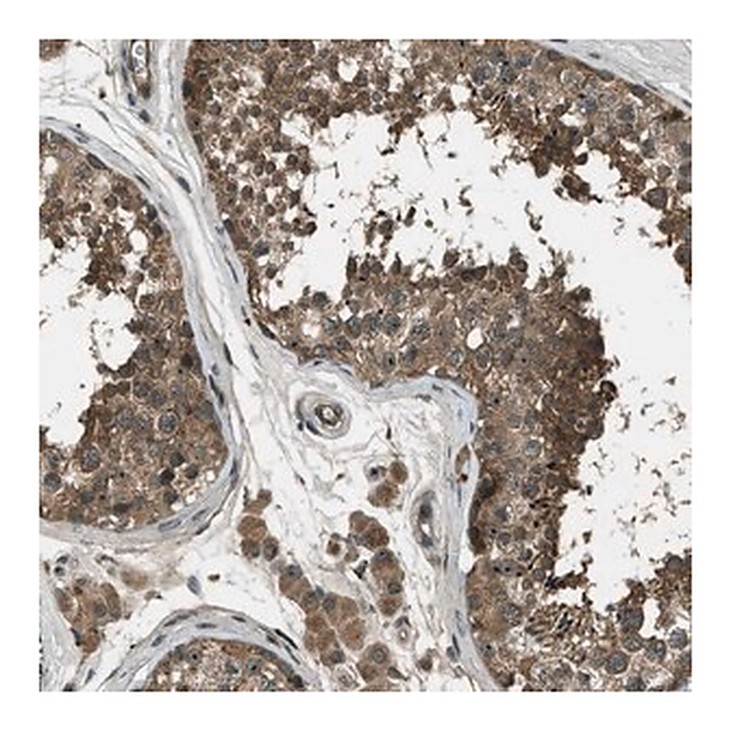 Merck Anti-STK11 antibody produced in rabbit