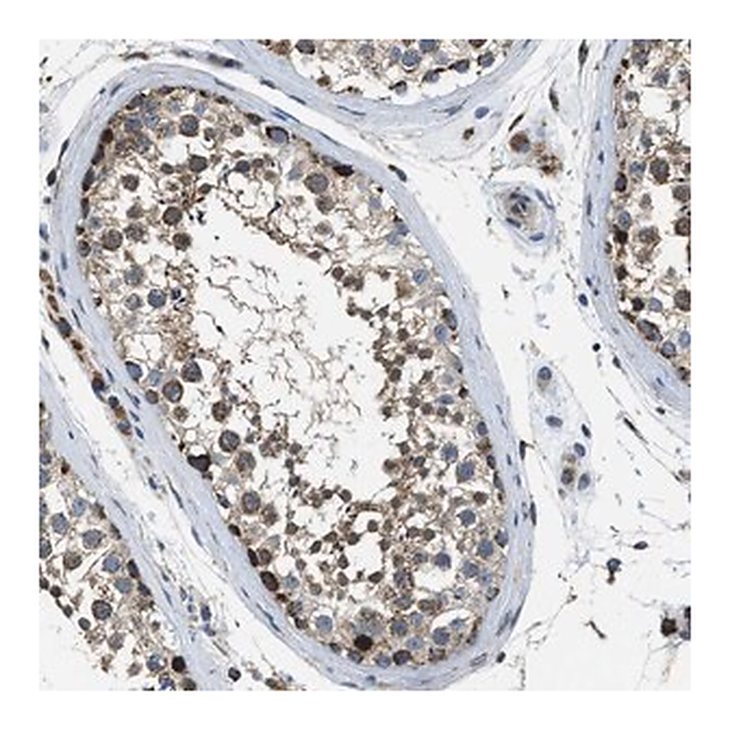 Merck Anti-STK33 antibody produced in rabbit