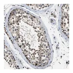 Merck Anti-STK33 antibody produced in rabbit