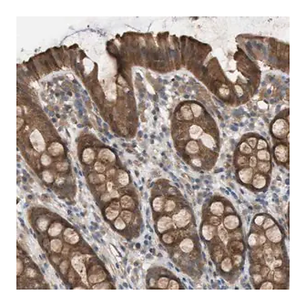 Merck Anti-PALD1 antibody produced in rabbit