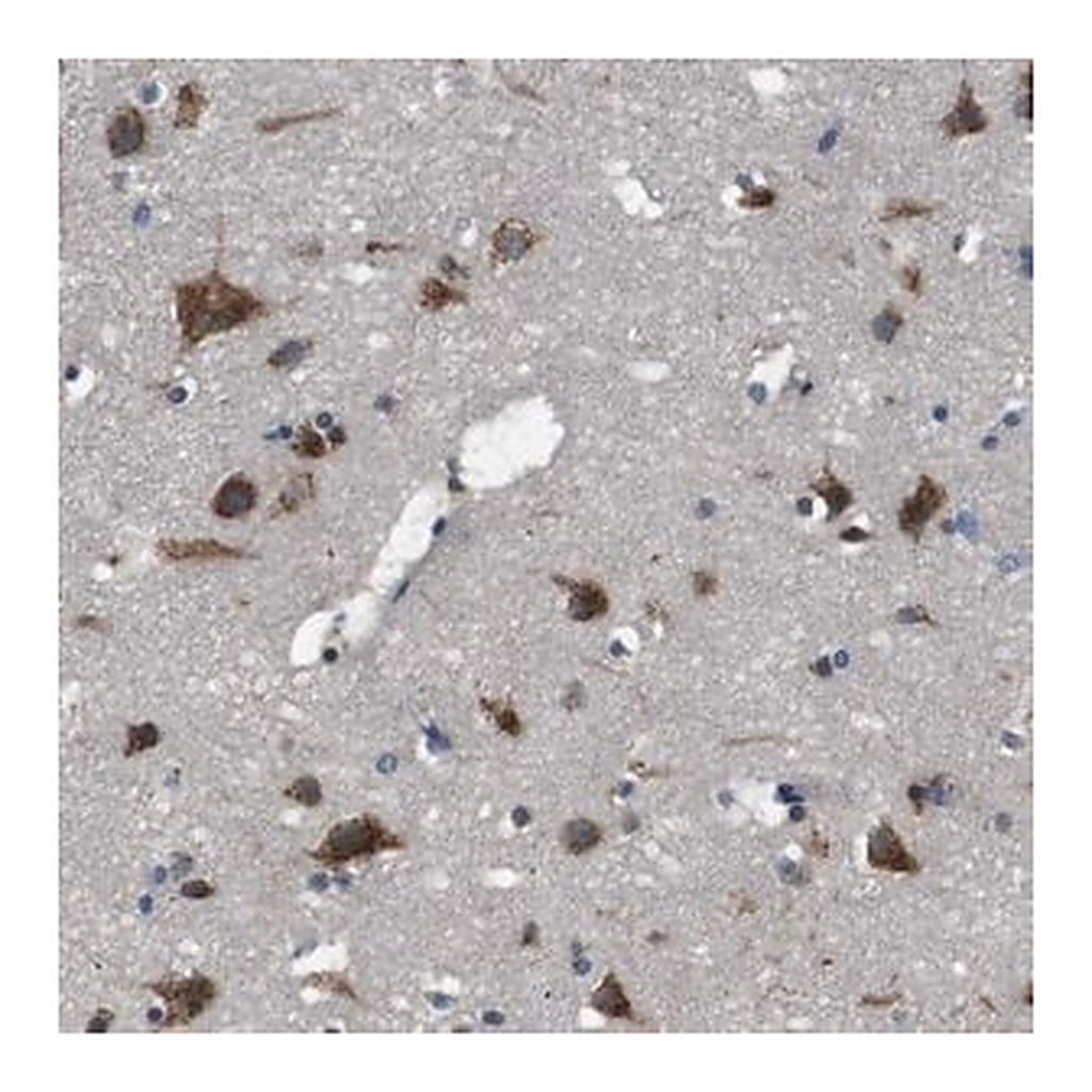 Merck Anti-TMED2 antibody produced in rabbit
