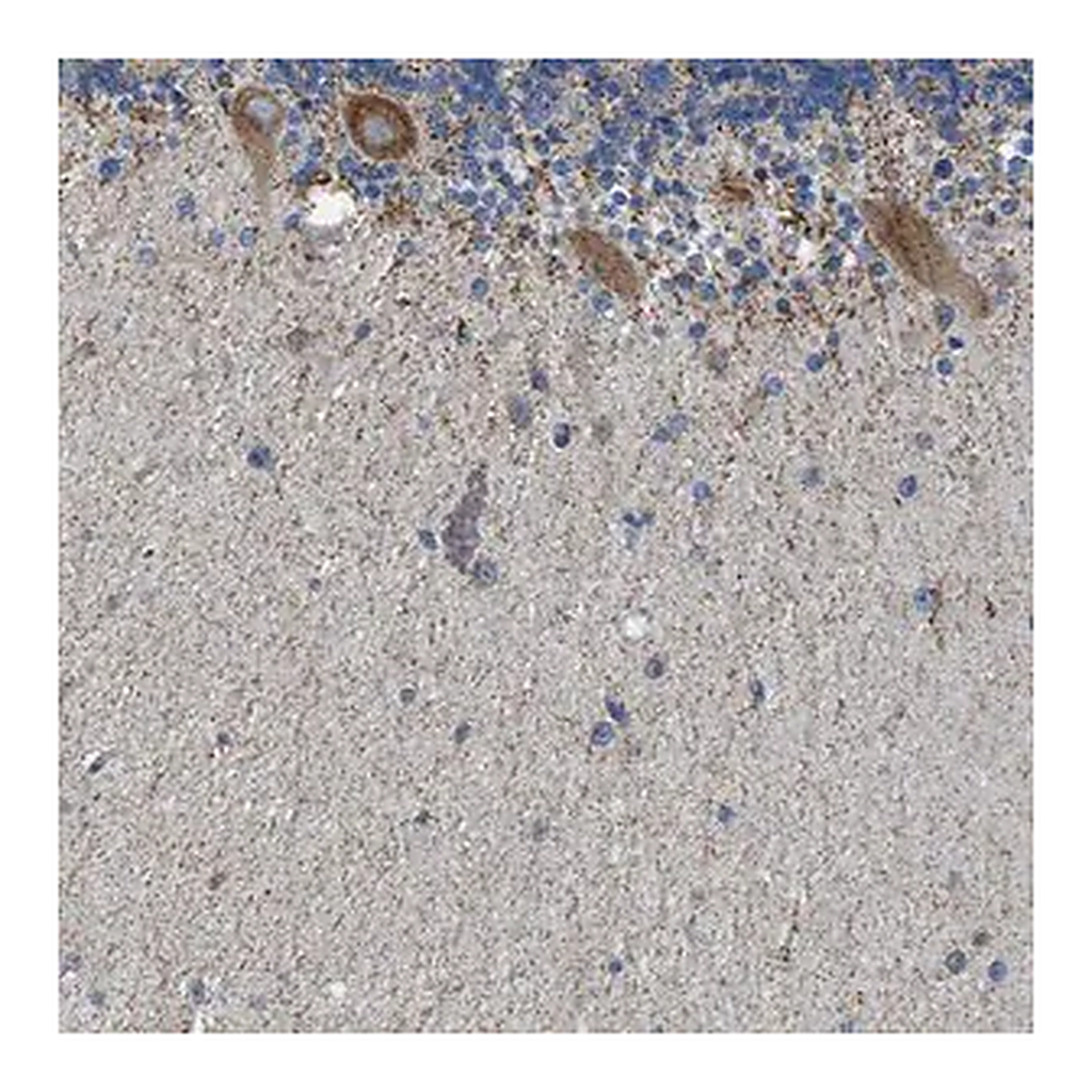 Merck Anti-CAMKK2 antibody produced in rabbit