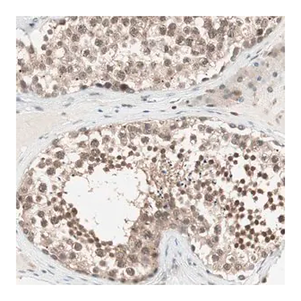 Merck Anti-UBE2I antibody produced in rabbit