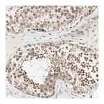 Merck Anti-UBE2I antibody produced in rabbit