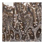 Merck Anti-EPSTI1 antibody produced in rabbit